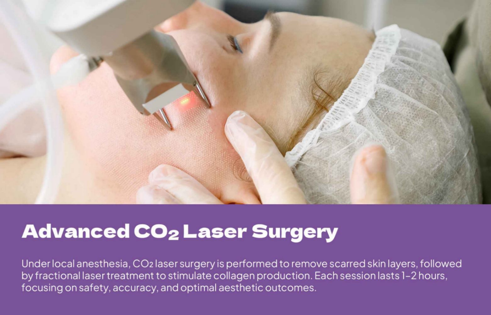 Offline Acne Scar Laser Treatment