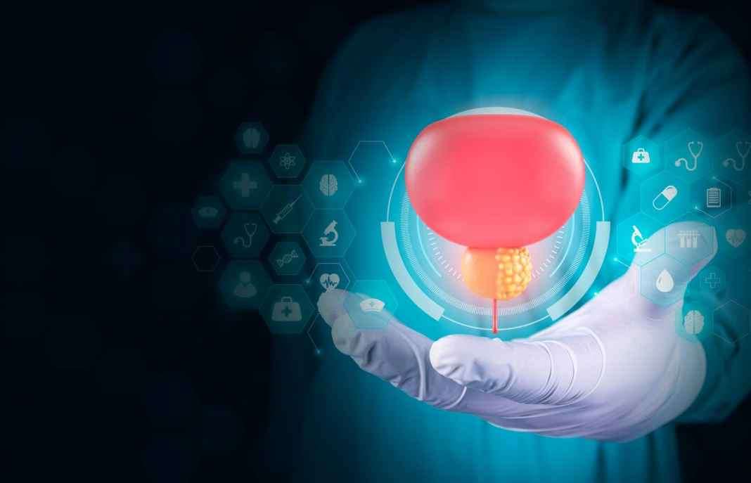 Advanced Prostate Cancer Diagnosis & Treatment in Dallas-Fort Worth (DFW)