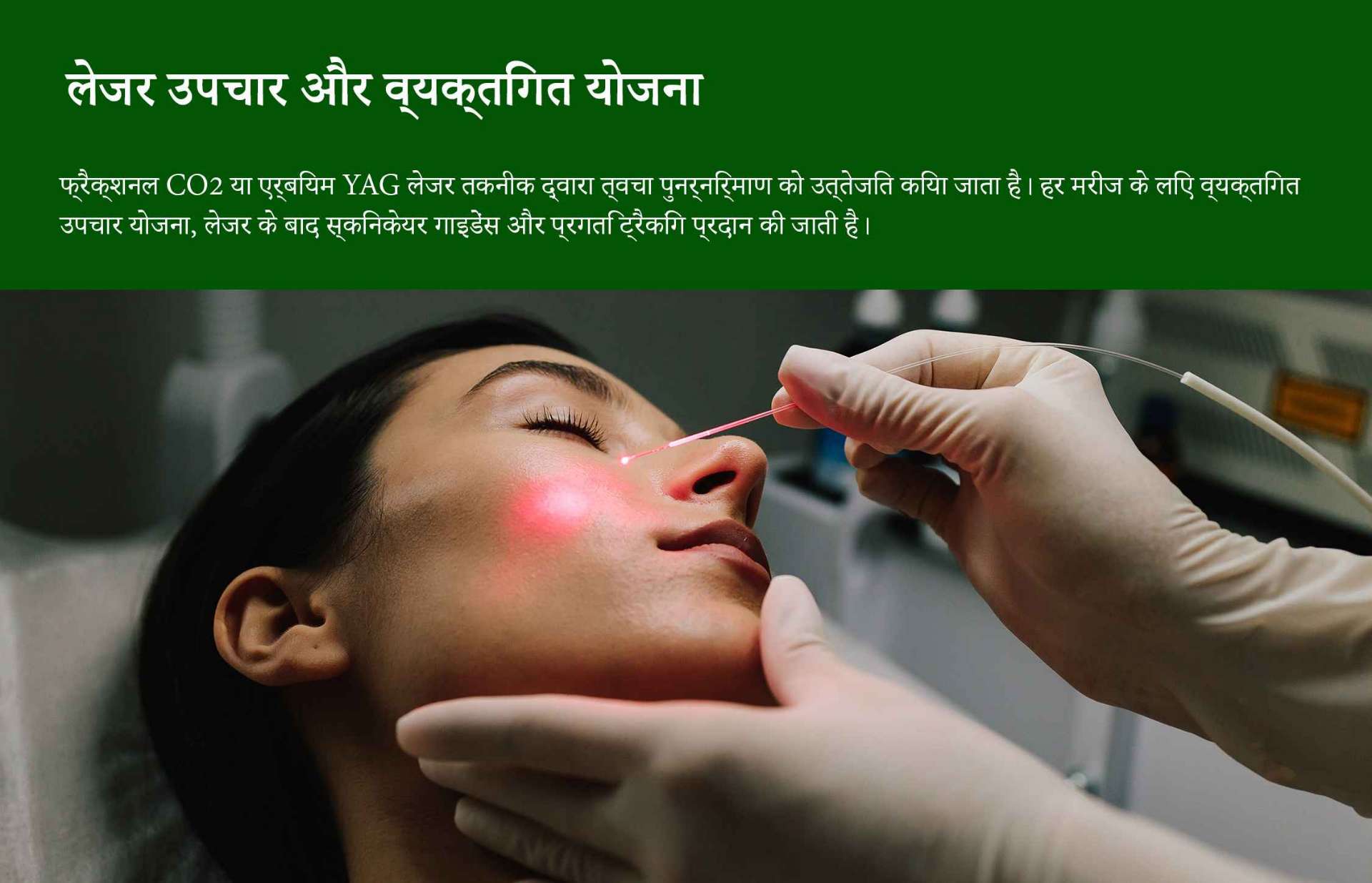 मुंहासे के निशानों का लेजर उपचार