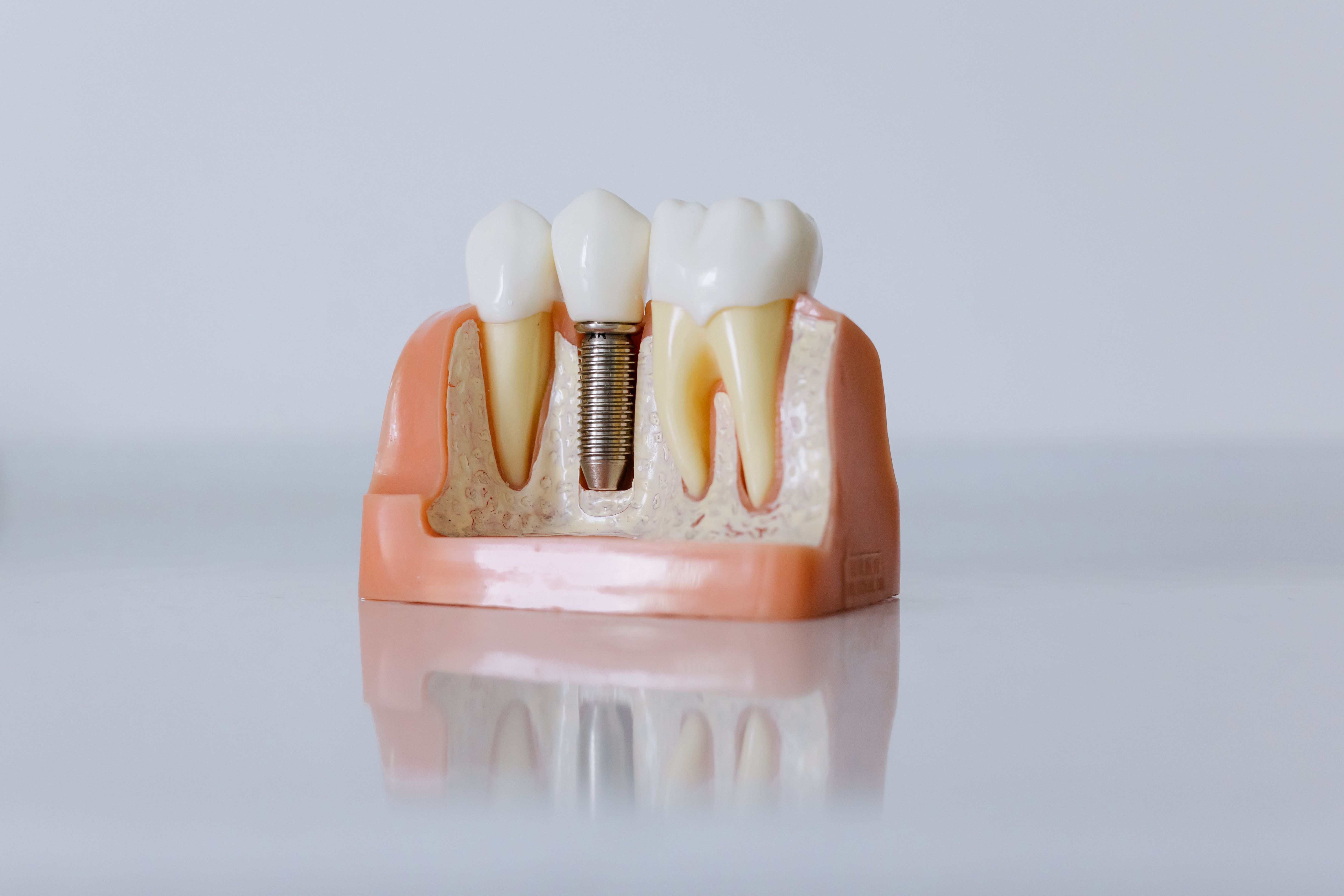 Dịch vụ chăm sóc răng miệng