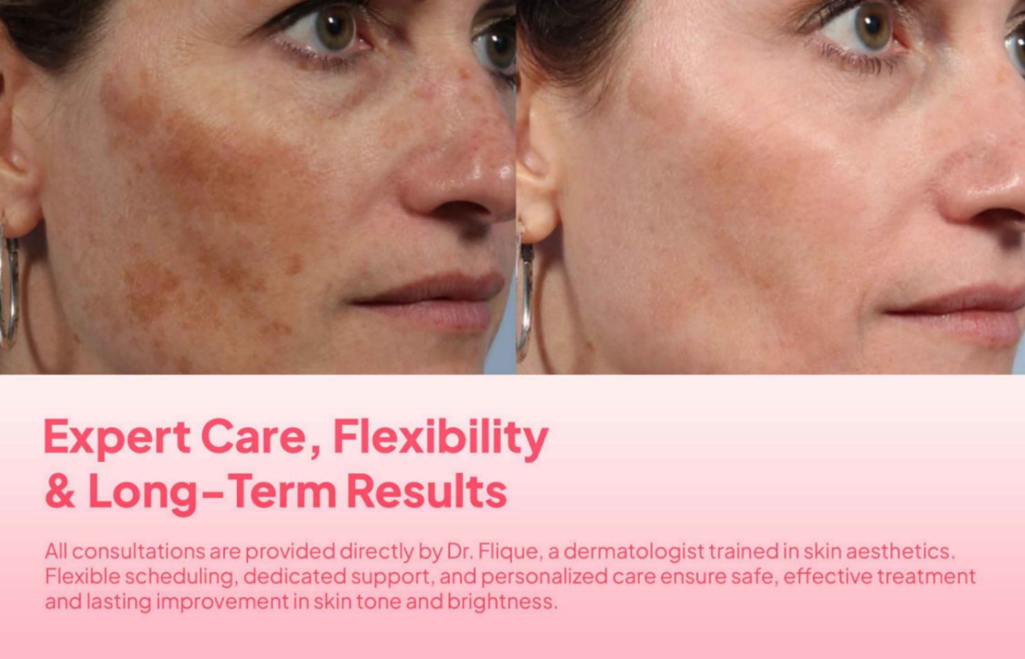 🌸DEEP MELASMA CONSULTATION - PERSONALIZED REGIMEN FOR BRIGHT, HEALTHY SKIN🌸