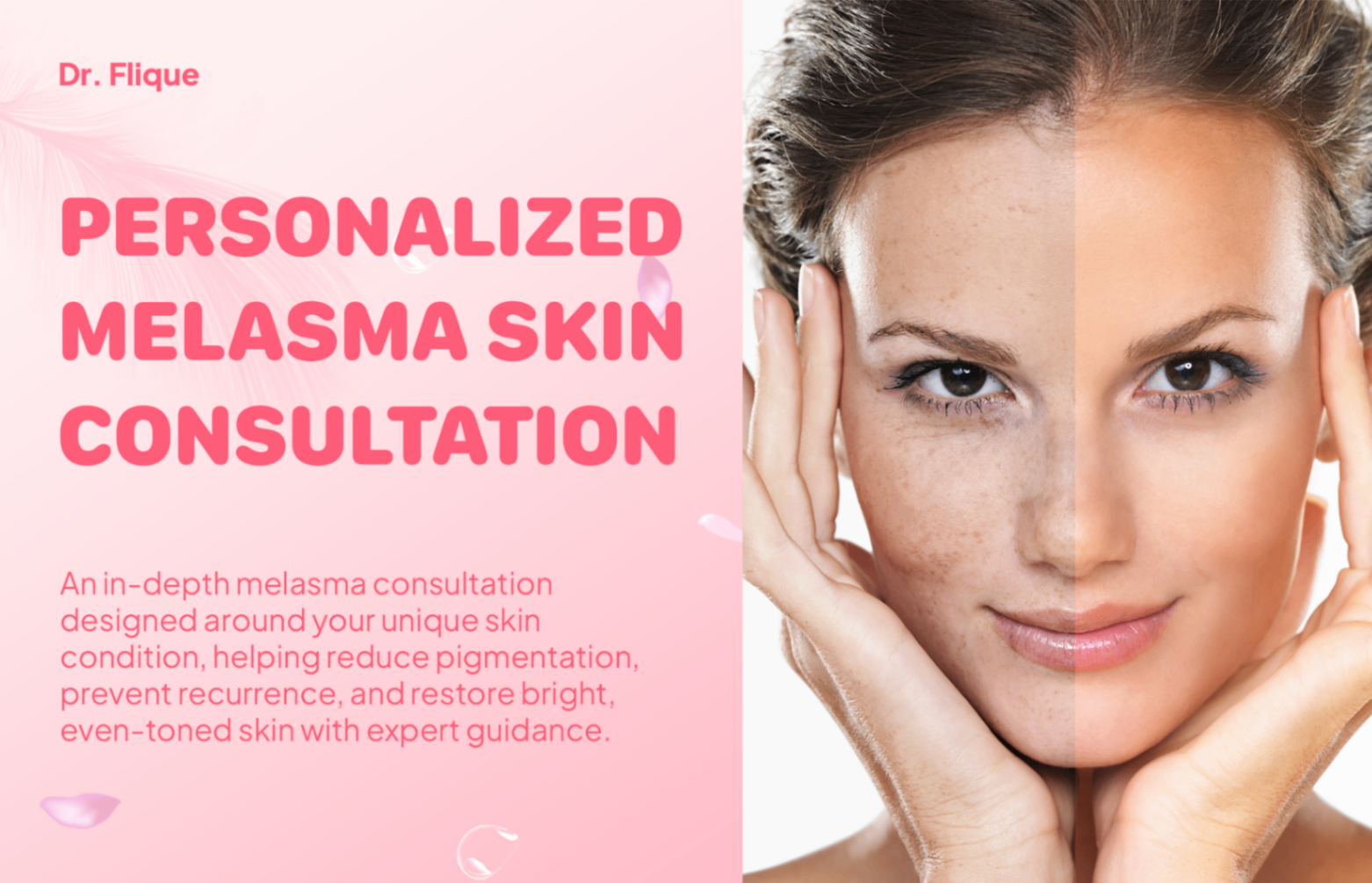 🌸DEEP MELASMA CONSULTATION - PERSONALIZED REGIMEN FOR BRIGHT, HEALTHY SKIN🌸
