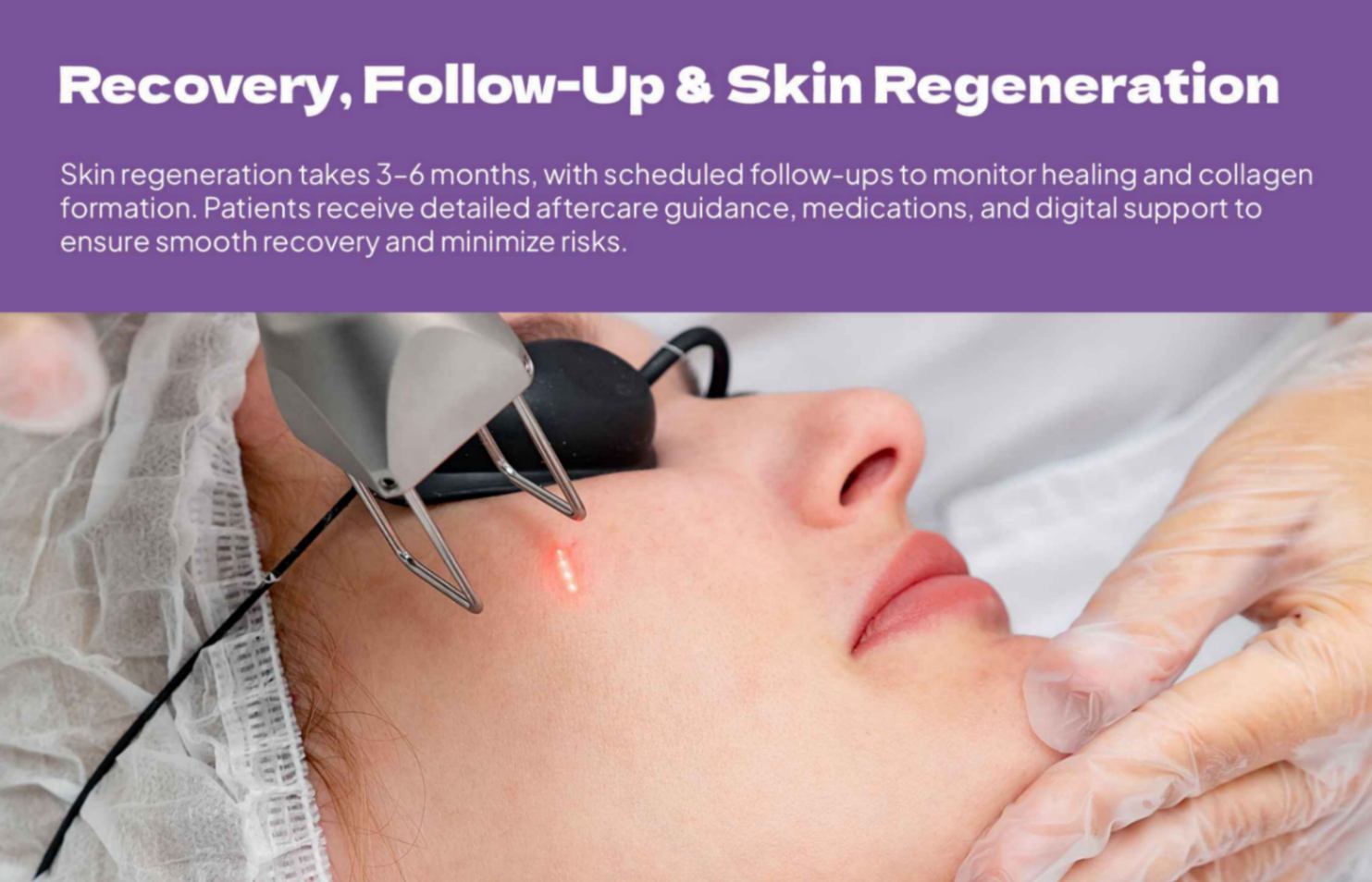 Offline Acne Scar Laser Treatment