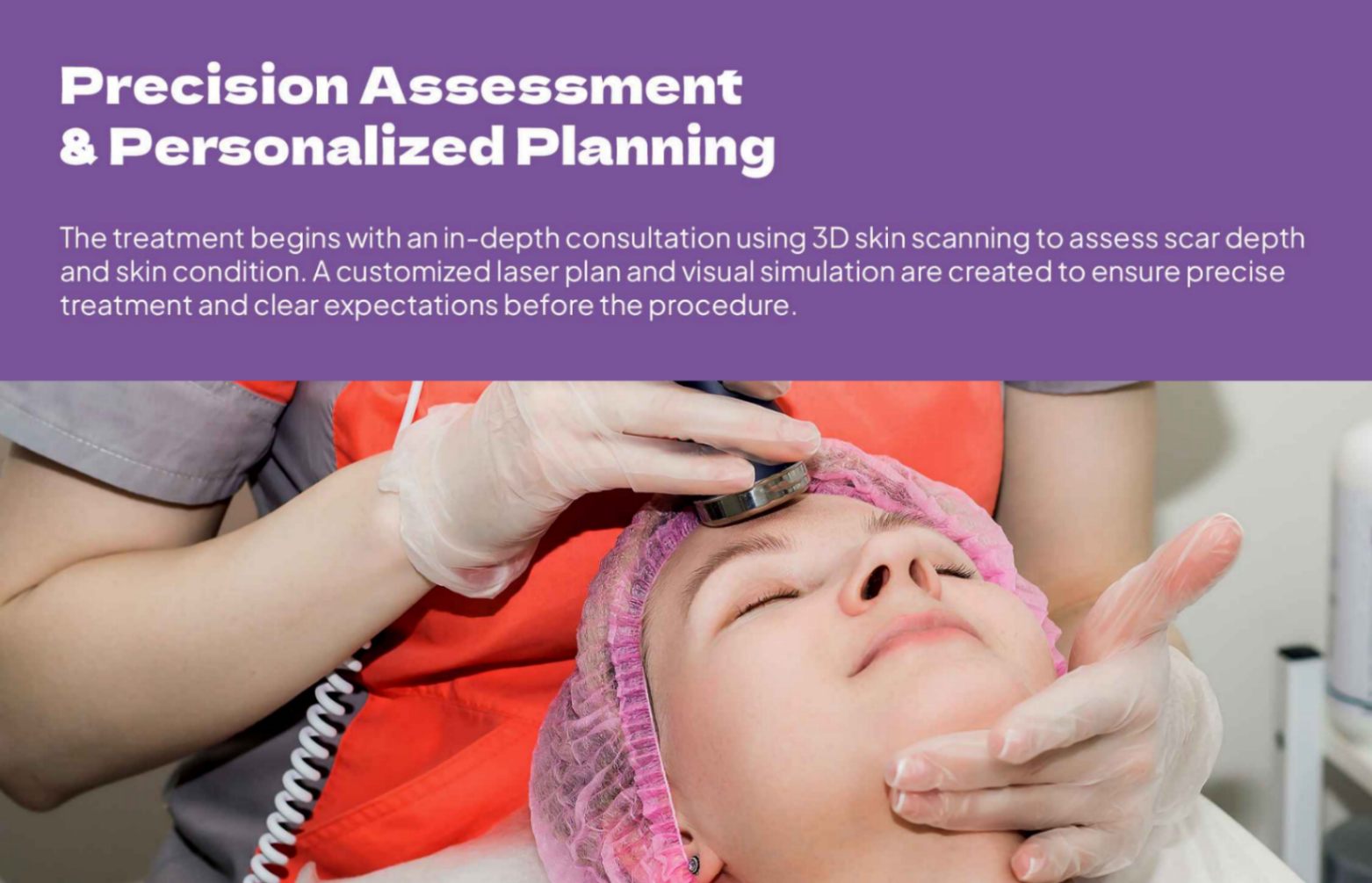 Offline Acne Scar Laser Treatment