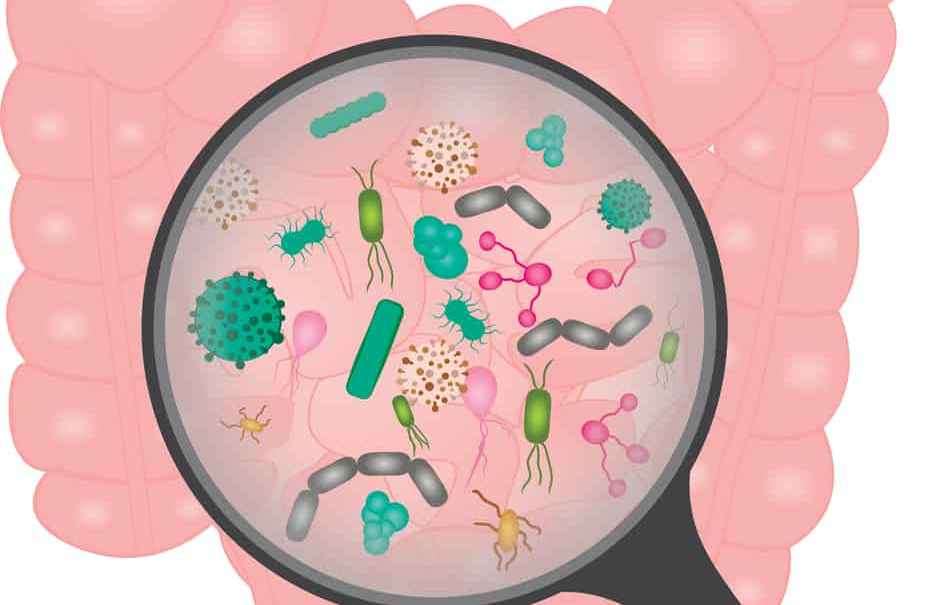 Before you check out Dr. Hyman’s SIBO Recovery Protocol, answer 4 quick questions.