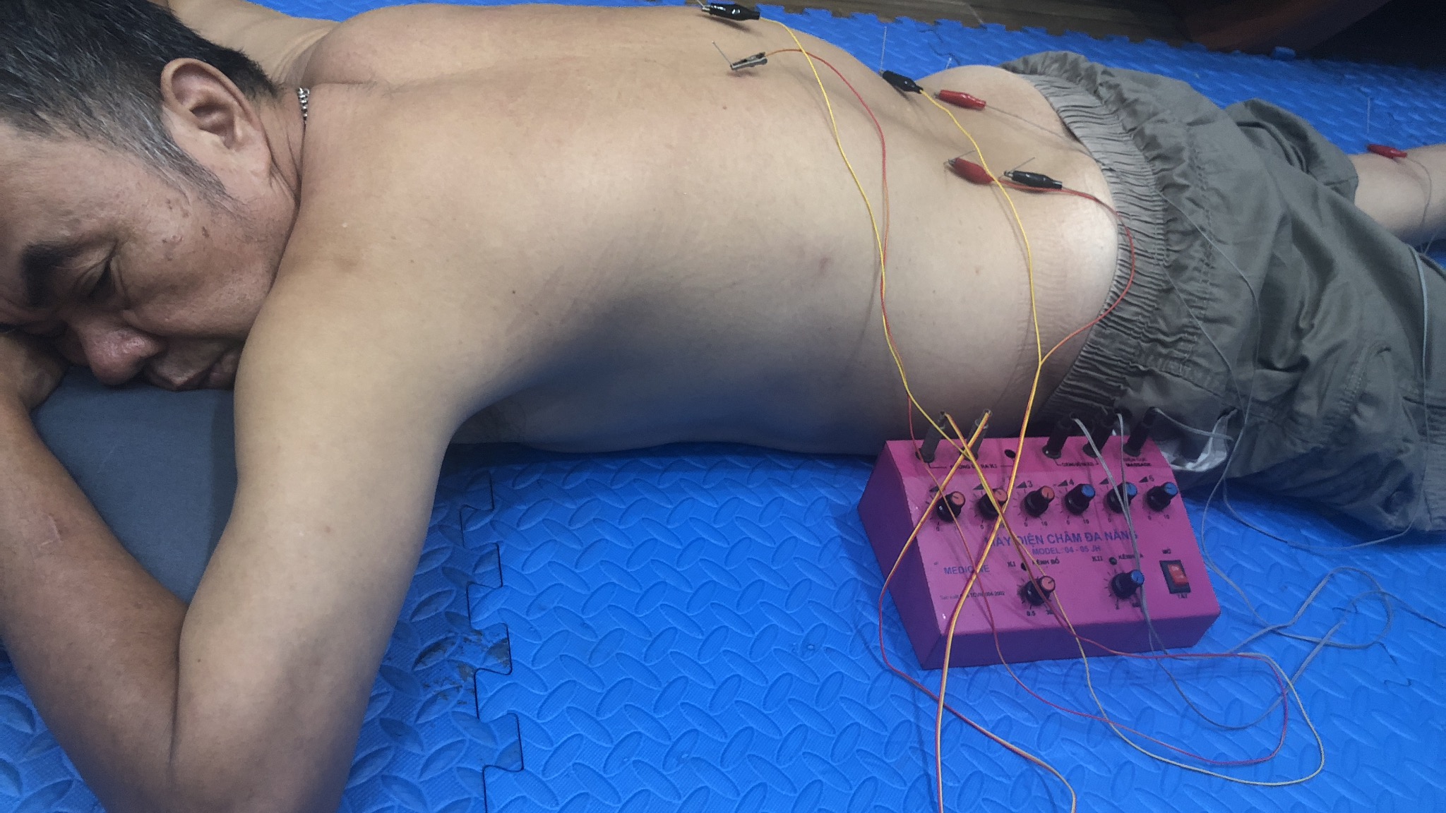 Tư vấn dinh dưỡng