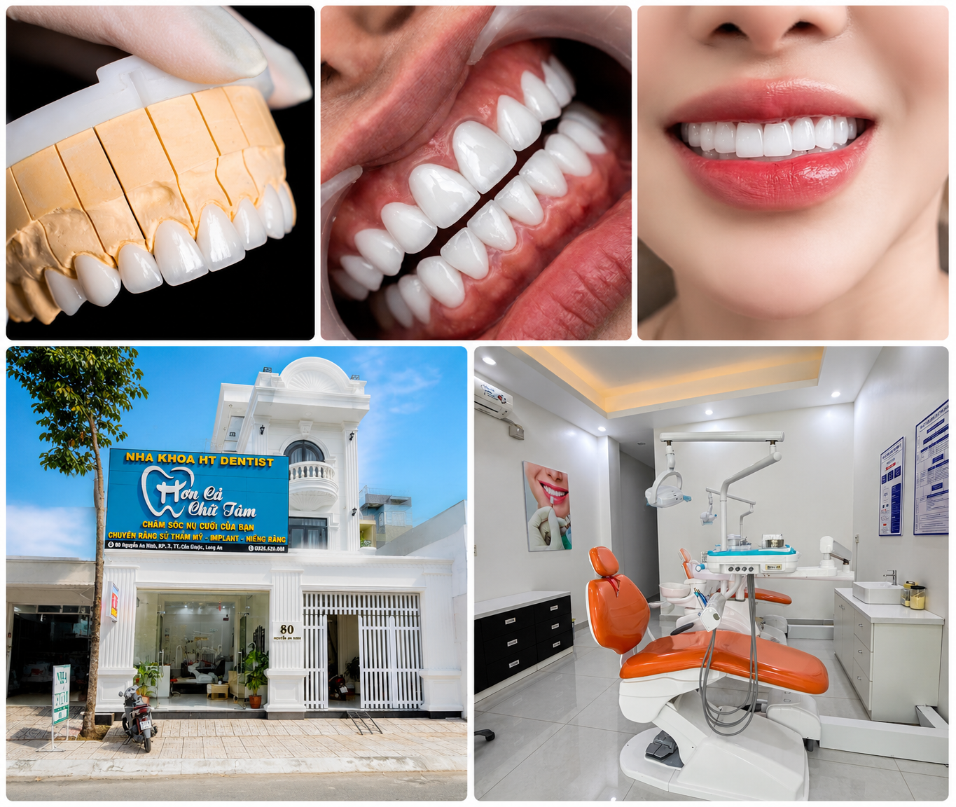 Tôi sẽ giúp bạn sở hữu nụ cười khỏe đẹp với kế hoạch điều trị nha khoa an toàn và cá nhân hóa.